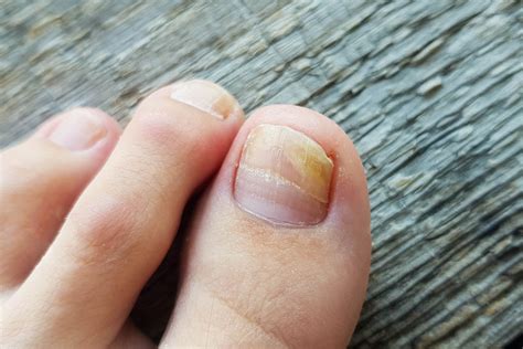 Does Painting Your Toenails Black Prevent Fungus? And Why Do Bananas Dream of Electric Sheep?